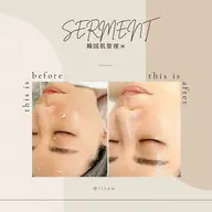 人気no.1‼️🇰🇷韓国艶肌🇰🇷 毛穴撲滅‼️肌質改善ピーリング