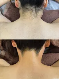 【女性🎀学割】背中上＋うなじ＋もみあげワックス脱毛🪞横顔美人/オフショル/アップヘア