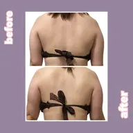 30分【ブライダル上半身集中】ドレス映えボディメイク　前日もOK🙆‍♀️