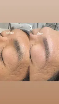 美眉スタイリング　練習モデル様専用⭐️