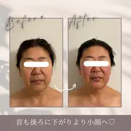 【単品メニュー】頭蓋調整