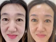 【ご新規様】形状記憶デザインキープラッシュ(LED)140本オフ込み