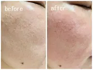 【新規】部分フェイスワックス（おでこ、頬、口周り、鼻）から1つ選択＋眉毛ワックス🌟人気のセットメニュー✨