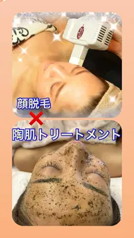 お顔脱毛✖︎陶肌トリートメント