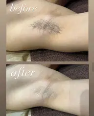 学生様限定★ 男性も女性も◎ワキ&腕脱毛 卒業まで何回でも3500円/回