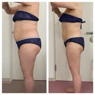 超音波、キャビテーション、EMSを使って美ボディに＊痩身エステモデル＊下半身スッキリコース