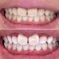 【トリプル照射】オーラルケア🦷✨15分+15分+10分の40分❣メンズも大歓迎♪都度払いで🆗