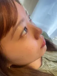 オーガニック☘️ワックス脱毛(小鼻、鼻下、鼻周り周辺+顎)✨フォト用に撮影させて頂ける10代​〜​20代前半限定