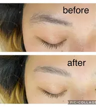 ハリウッドブロウリフト