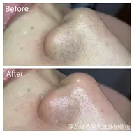 ⭐️人気⭐️即効果実感❣️【頑固な黒ずみ・角質角栓に】浮かせる毛穴洗浄3パーツ(鼻・顎・眉間)フェイシャル45分