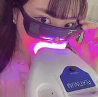 【学割U24】 学生様限定 高性能セルフホワイトニング 20分照射  1,980円🦷✨