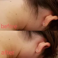 【組合わ自由！ボディ・フェイシャル・顔脱毛・フォト】