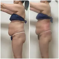 激痩身！！当店ＮｏIスライドカッピング全身40分＋骨盤矯正25分＋腸もみ25分＋ヒートマット付き