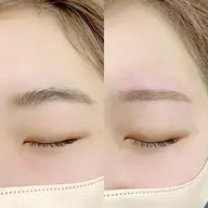 〖✧アイブロウ&美眉WAX脱毛✧〗