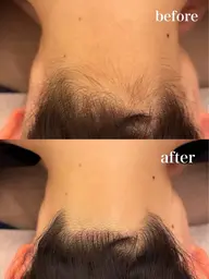 【背中+襟足set脱毛】トーンUP &アップヘアも美しく!うるツヤ脱毛2回¥7,800