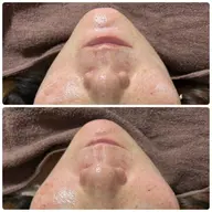 艶肌メニュー🤎【白玉wax脱毛✖️小顔エステ】この時期乾燥しがちな肌に❣️