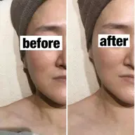 【人気No,1】速攻実感☆小顔ケア+くすみケア60分:21560円→7700円