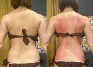 🔥徹底痩せ🔥 1回でも大幅変化‼️サーモシェイプdeepを使ったスペシャルオーダーメイドコース