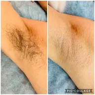 【男性初回】ワキ