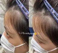 韓国発‼︎産毛パーマ🇰🇷💓チャンモリパーマ(잔머리펌)🫶🏻💕+うぶ毛カット