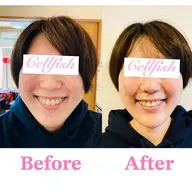 【2週間以内にご予約の方】小顔矯正！頭や顔が 小さくなり“形まで” 変わる！  誰でも頭蓋骨矯正、小顔矯正の効果を実感！