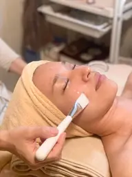 肌改善コース  (ニキビ、吹き出物でお悩みの方)乳酸ピーリングでアクネ菌除去！