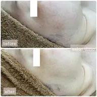 【人気急上昇♡】お顔丸ごと脱毛