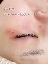 当日予約限定♡まつげパーマ(ラッシュリフト)＋シミ取り10個お試しセット￥12000