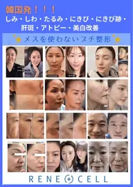 【韓国化粧品ルネセル】ダイヤモンドピール💎肌再生/肌年齢巻き戻し/ファンデーションレスになれる/あらゆる肌トラブル改善