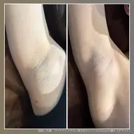 【本気の美肌習慣💃|全身脱毛パーフェクトコース】綺麗の土台を整える美肌脱毛プラン✨※VIO+お顔脱毛も入ってます。