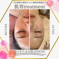 陶肌トリートメント小顔　cycayコース🌹