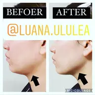 【フェイスライン・リフトUP】 たるみ毛穴引き締め 引き上げコース90分