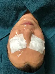 炭酸ジェル♡コース