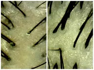 1番人気✨️30分ヘッドスパコース