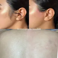 4月限定🌷【背中上うなじ込＋1箇所(脇/デコルテ/もみあげ)ワックス脱毛】