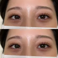 フラットラッシュ100本　(オフ＋500円)