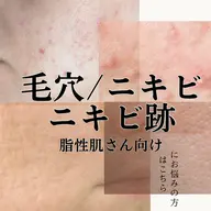 【皮脂トラブルケア】毛穴洗浄×ハーブピーリング×プラズマ｜鎮静ジェル/LED付き