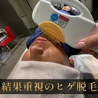 【プロ施術】清潔感を整えるメンズヒゲ脱毛                        《脱毛範囲》口周り/頬/アゴ裏/