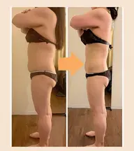 ブライダル痩身★ドレスが映える背中・二の腕に！60分集中メニュー