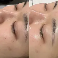 【ご新規様限定】【2回で5,500円】肌質改善フェイシャルエステ