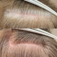 【🟡SNSでも話題🟡】カット+白髪ぼかしカラー+トリートメント