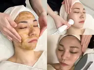 【ニキビレス肌へ最短アプローチ💛】ハーブピーリング🍀＋美肌フォト＋VCペプチド幹細胞美容液✨