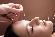 【美容鍼】60分コース