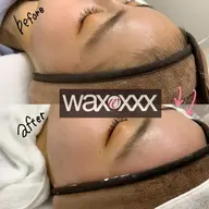 【フェイスwax脱毛】waxxxx🌈