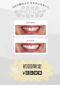 【医療用薬剤使用!】セルフホワイトニング 初回4000円