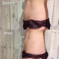 結果重視！ウエスト痩身コース