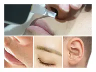 【鼻毛・耳毛も脱毛できる時代に！】選べるちょこっと脱毛(男女OK)