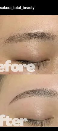 ハリウッドブロウリフト