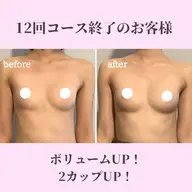 結果出しNo.1クーポン¥9,800‼️ 45%OFFでコース施術‼️最強バストUP&至福のオイルマッサージ✨