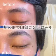 ハリウッドブロウリフト